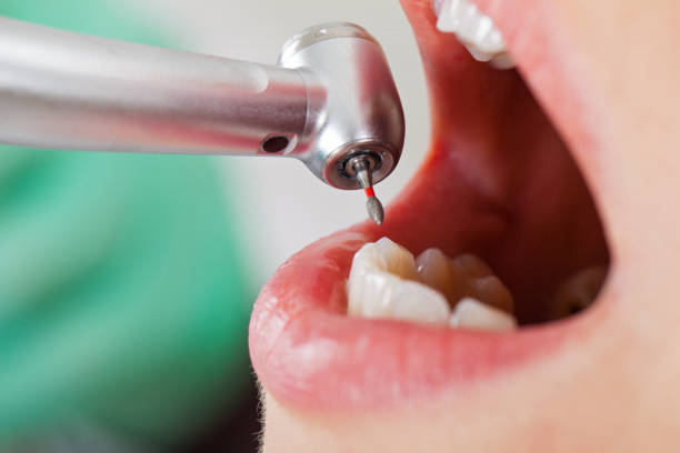 Best Broken or Cracked Tooth Emergency Dentist in Kingsport, TN